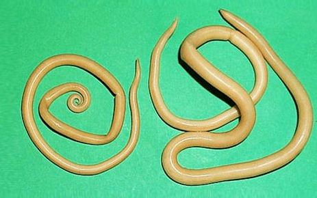 Toxokara