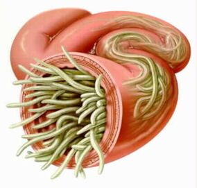 Parasites in the bowels