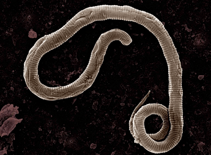 Where do the worms come from the human body