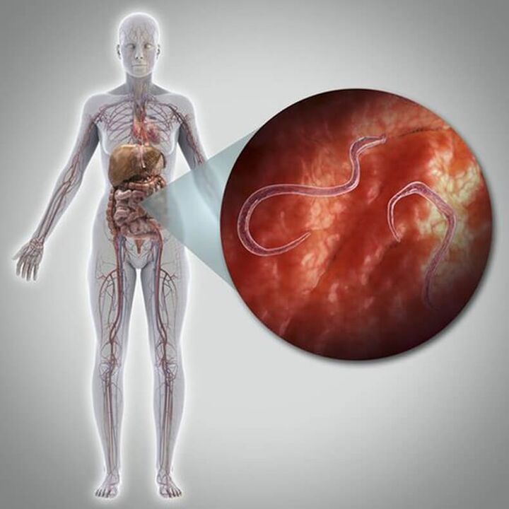 Parasites in a person's body