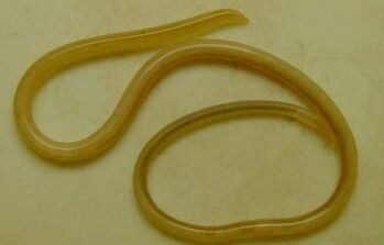Types of parasites in human body